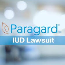 Paragard IUD Lawsuit